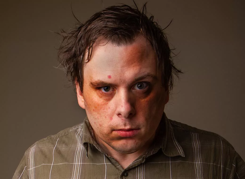 Most Common Meth Withdrawal Symptoms