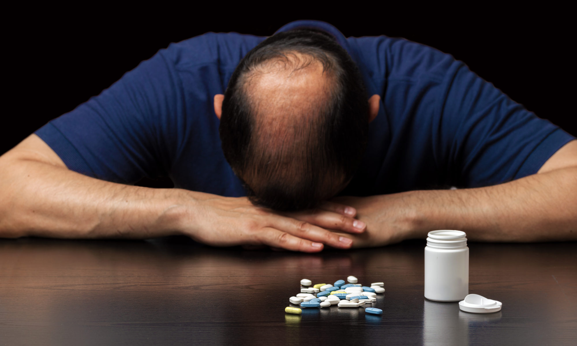 Drug Addiction and Hair Loss
